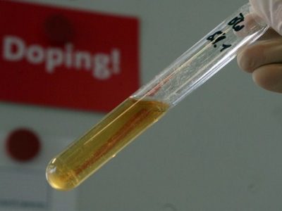 ANTIDOPING UMANO: Iniziati controlli a campione nella manifestazioni nazionali